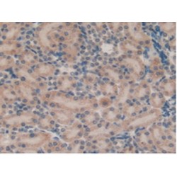 Pulmonary Surfactant-Associated Protein B (SFTPB) Antibody