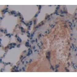 Pulmonary Surfactant-Associated Protein C (SFTPC) Antibody
