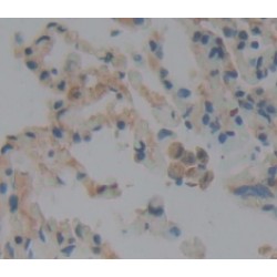 Pulmonary Surfactant Associated Protein D / SP-D (SFTPD) Antibody