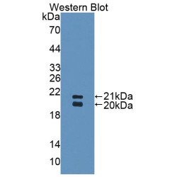Pulmonary Surfactant-Associated Protein D (SFTPD) Antibody