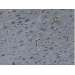 Allograft Inflammatory Factor 1 (AIF1) Antibody