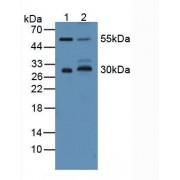 Western blot analysis of (1) Mouse Brain Tissue and (2) Mouse Lung Tissue.