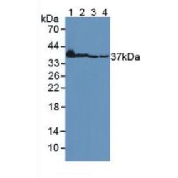 Connective Tissue Growth Factor (CCN2) Antibody