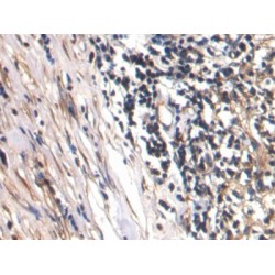 Connective Tissue Growth Factor (CCN2) Antibody
