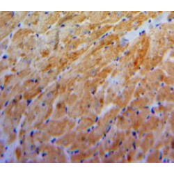 Connective Tissue Growth Factor (CCN2) Antibody