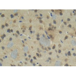 Connective Tissue Growth Factor (CCN2) Antibody