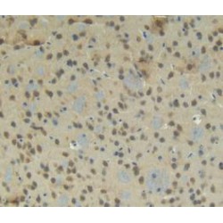 Connective Tissue Growth Factor (CCN2) Antibody