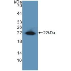 Early Growth Response 1 (EGR1) Antibody