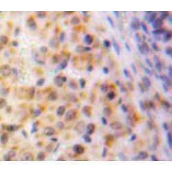 Early Growth Response 1 (EGR1) Antibody