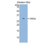Western blot analysis of the recombinant Mouse EGR2.