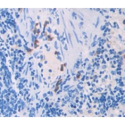 Tumor Necrosis Factor Ligand Superfamily Member 6 (FASLG) Antibody