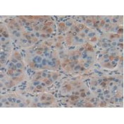Tumor Necrosis Factor Ligand Superfamily Member 6 (FASLG) Antibody
