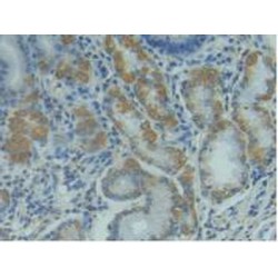 Tumor Necrosis Factor Ligand Superfamily Member 6 (FASLG) Antibody
