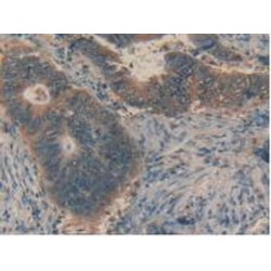 Tumor Necrosis Factor Ligand Superfamily Member 6 (FASLG) Antibody