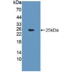 Glial Fibrillary Acidic Protein (GFAP) Antibody