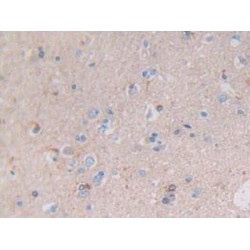 Glial Fibrillary Acidic Protein (GFAP) Antibody