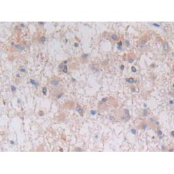 Glial Fibrillary Acidic Protein (GFAP) Antibody