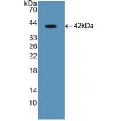 Glial Fibrillary Acidic Protein (GFAP) Antibody