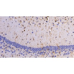 Glial Fibrillary Acidic Protein (GFAP) Antibody