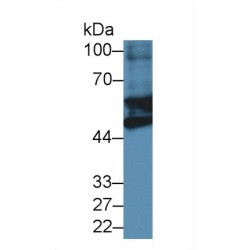 Glial Fibrillary Acidic Protein (GFAP) Antibody