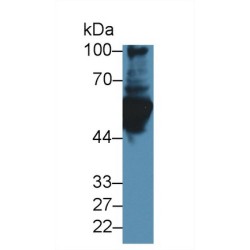 Glial Fibrillary Acidic Protein (GFAP) Antibody