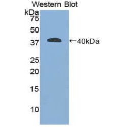 Glial Fibrillary Acidic Protein (GFAP) Antibody