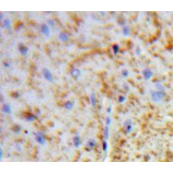 Glial Fibrillary Acidic Protein (GFAP) Antibody