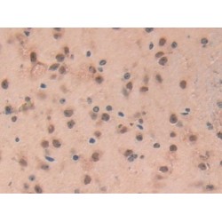 Glial Fibrillary Acidic Protein (GFAP) Antibody
