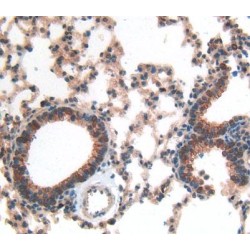 Glial Fibrillary Acidic Protein (GFAP) Antibody
