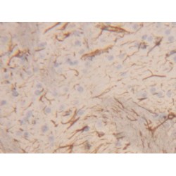 Glial Fibrillary Acidic Protein (GFAP) Antibody