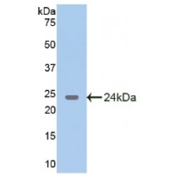 Glutamate Decarboxylase 2 (GAD2) Antibody