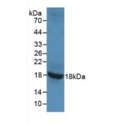 Western blot analysis of recombinant Rat GAD2.