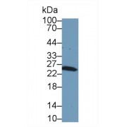 Western blot analysis of Rat Kidney lysate, using Rat GSTm1 Antibody (1 µg/ml) and HRP-conjugated Goat Anti-Rabbit antibody (<a href="https://www.abbexa.com/index.php?route=product/search&amp;search=abx400043" target="_blank">abx400043</a>, 0.2 µg/ml).