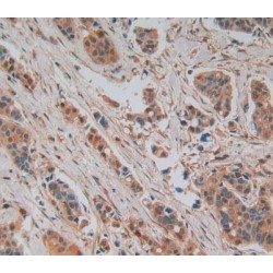 Glutathione S Transferase Mu 4 (GSTm4) Antibody