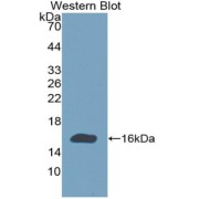 Western blot analysis of the recombinant protein.