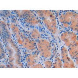 Growth Differentiation Factor 2 (GDF2) Antibody