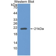 Western blot analysis of the recombinant protein.