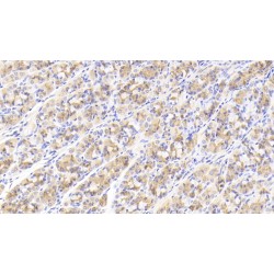 Growth Differentiation Factor 5 (GDF5) Antibody