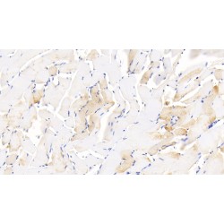 Growth Differentiation Factor 5 (GDF5) Antibody