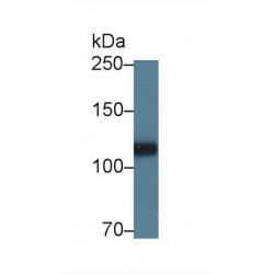 Heparan Sulfate Proteoglycan 2 (HSPG2) Antibody
