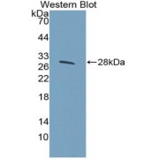 Western blot analysis of recombinant Human HSPG2 protein.