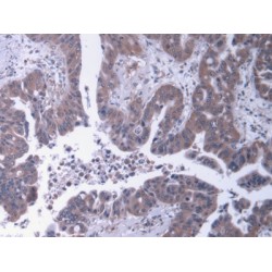 Heparan Sulfate Proteoglycan 2 (HSPG2) Antibody