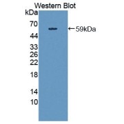Western blot analysis of recombinant HMWK.