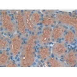 Kininogen 1 (KNG1) Antibody