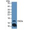 Interleukin 36 Gamma / IL1F9 (IL36G) Antibody