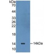 Western blot analysis of recombinant Human IL10Ra.