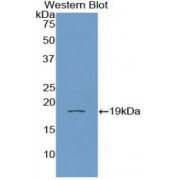 Western blot analysis of recombinant Human IL11Ra.
