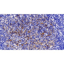 Interleukin 11 Receptor Alpha (IL11Ra) Antibody