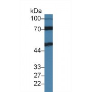 Western blot analysis of Rat Kidney lysate, using Mouse IL11Ra Antibody (1 µg/ml) and HRP-conjugated Goat Anti-Rabbit antibody (<a href="https://www.abbexa.com/index.php?route=product/search&amp;search=abx400043" target="_blank">abx400043</a>, 0.2 µg/ml).