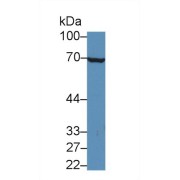 Western blot analysis of Mouse Liver lysate, using Mouse IL20Ra Antibody (5 µg/ml) and HRP-conjugated Goat Anti-Rabbit antibody (<a href="https://www.abbexa.com/index.php?route=product/search&amp;search=abx400043" target="_blank">abx400043</a>, 0.2 µg/ml).